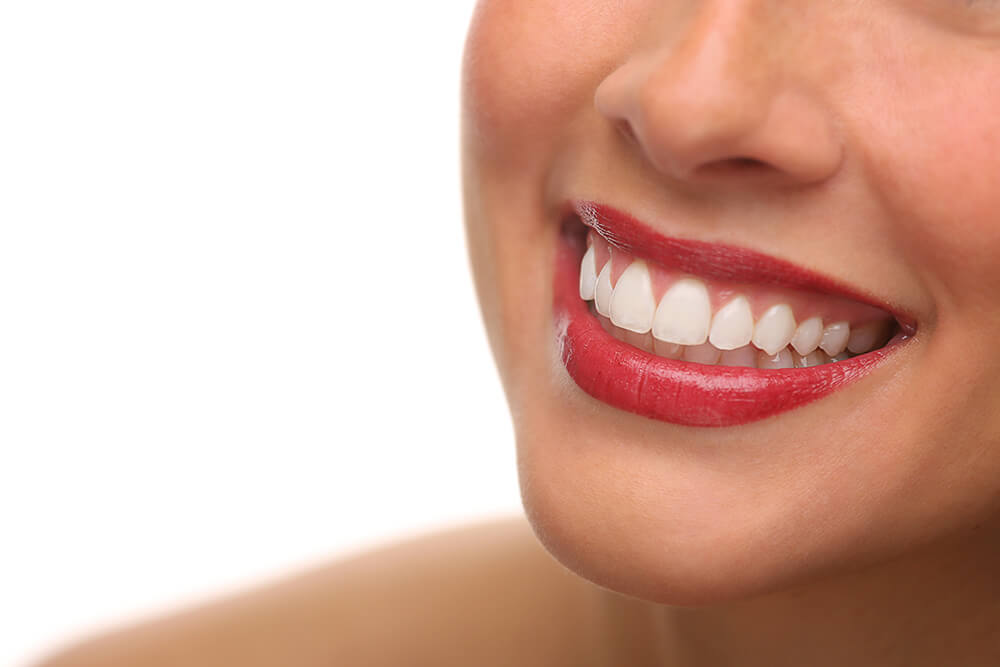 Hollywood Smile Nedir, Türleri Nelerdir?