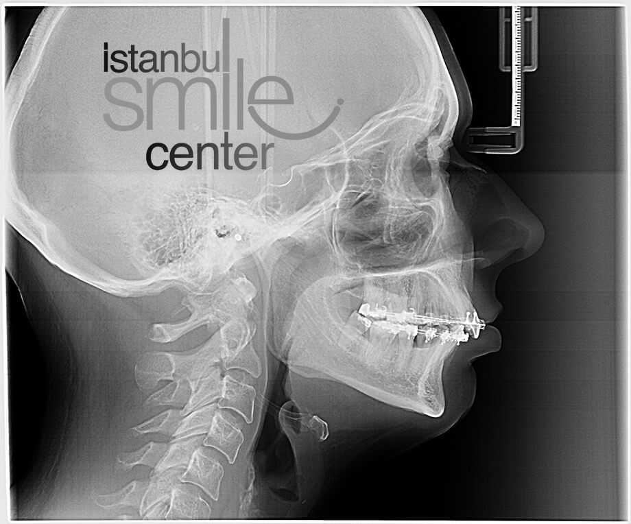 Ortodontist Nedir?