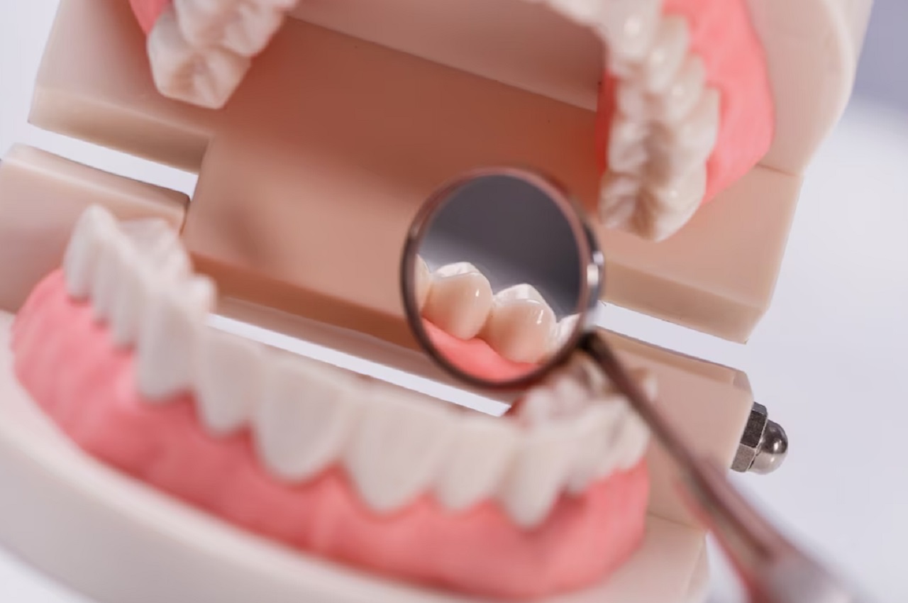 Sabit Protez Diş Nedir Nasıl Yapılır?