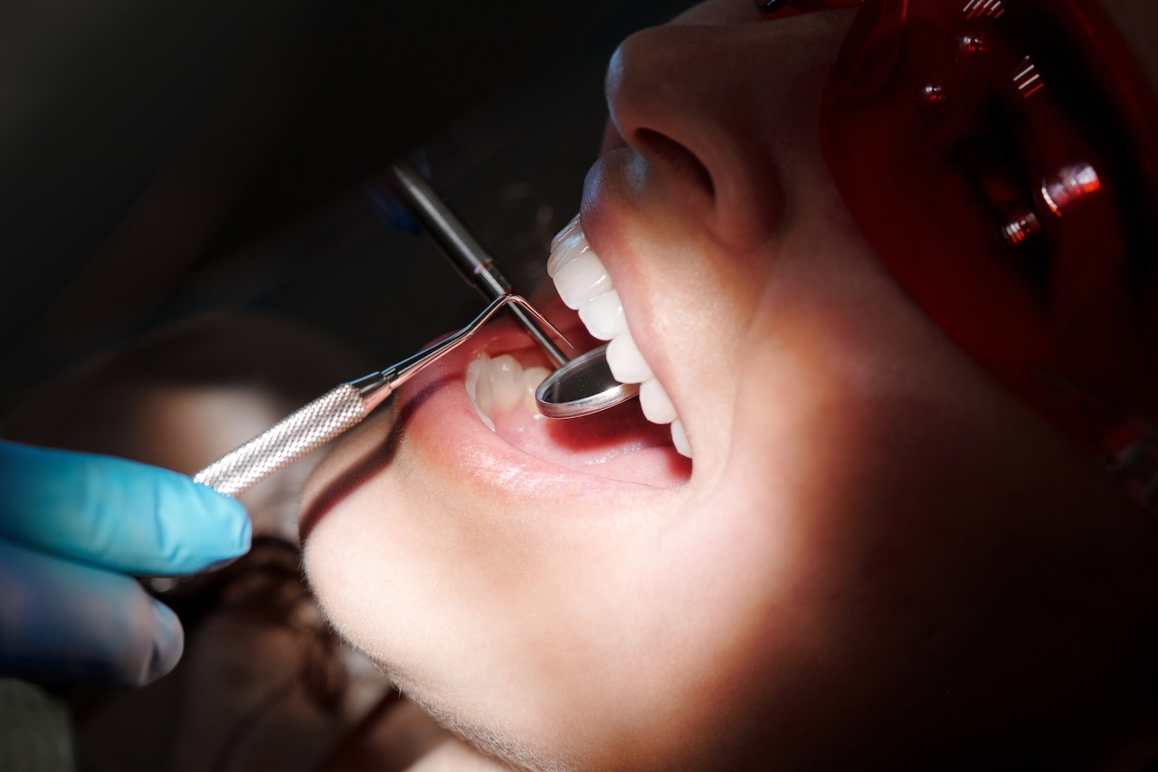 Periodontoloji Fiyatları 