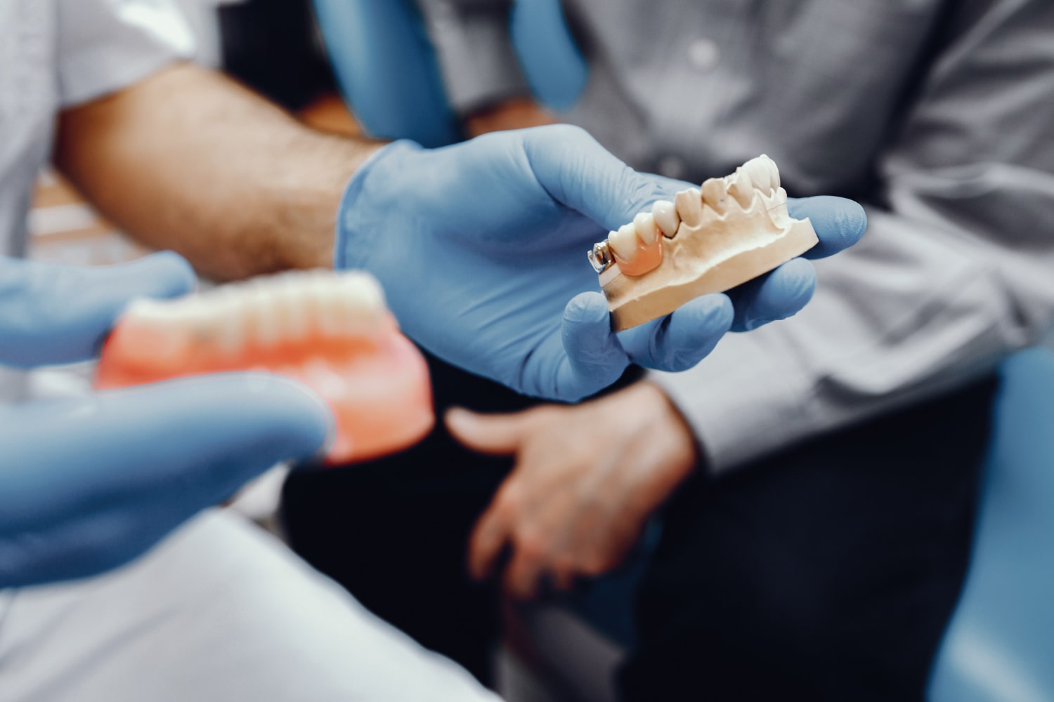 Yeni Nesil Diş Protezi Nedir? Avantajları Nelerdir?